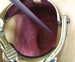 Carola park pim xet moi